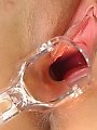 Young brunette tries speculum